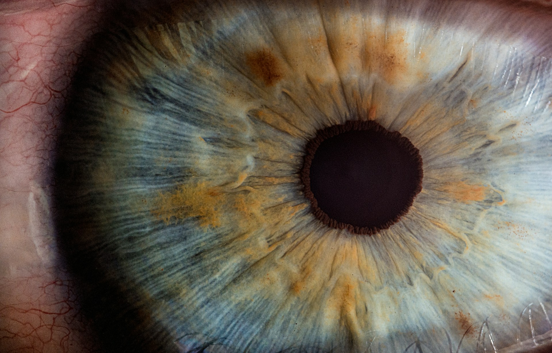 Close-up view of a human eye showing the pupil and iris.