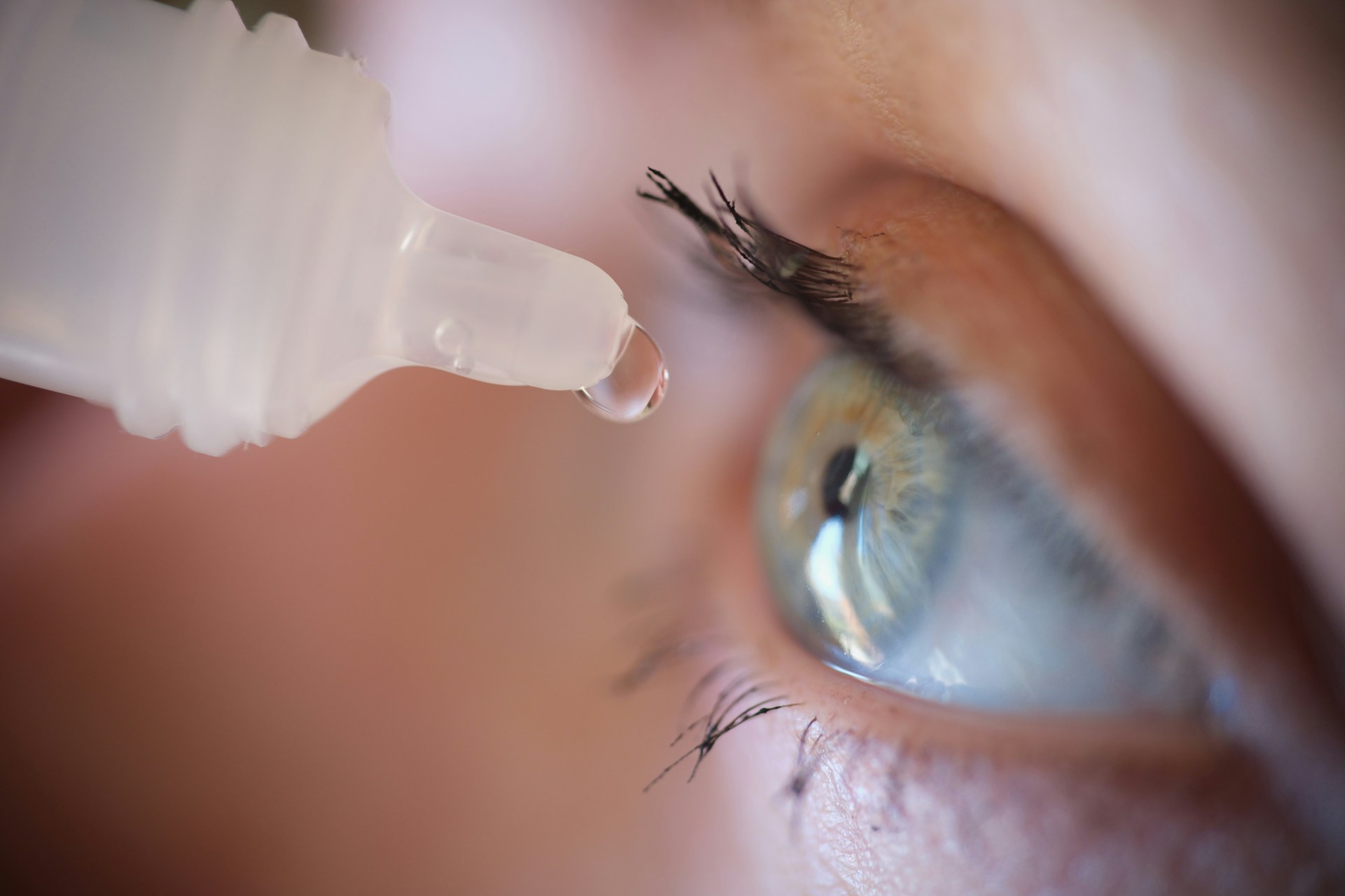 Close-up of a person applying eye drops to a red, irritated eye.