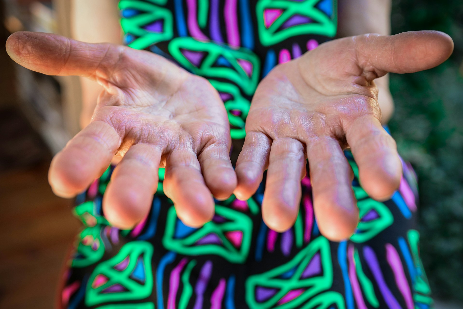 Close-up of a person holding both hands open with palms facing upward.