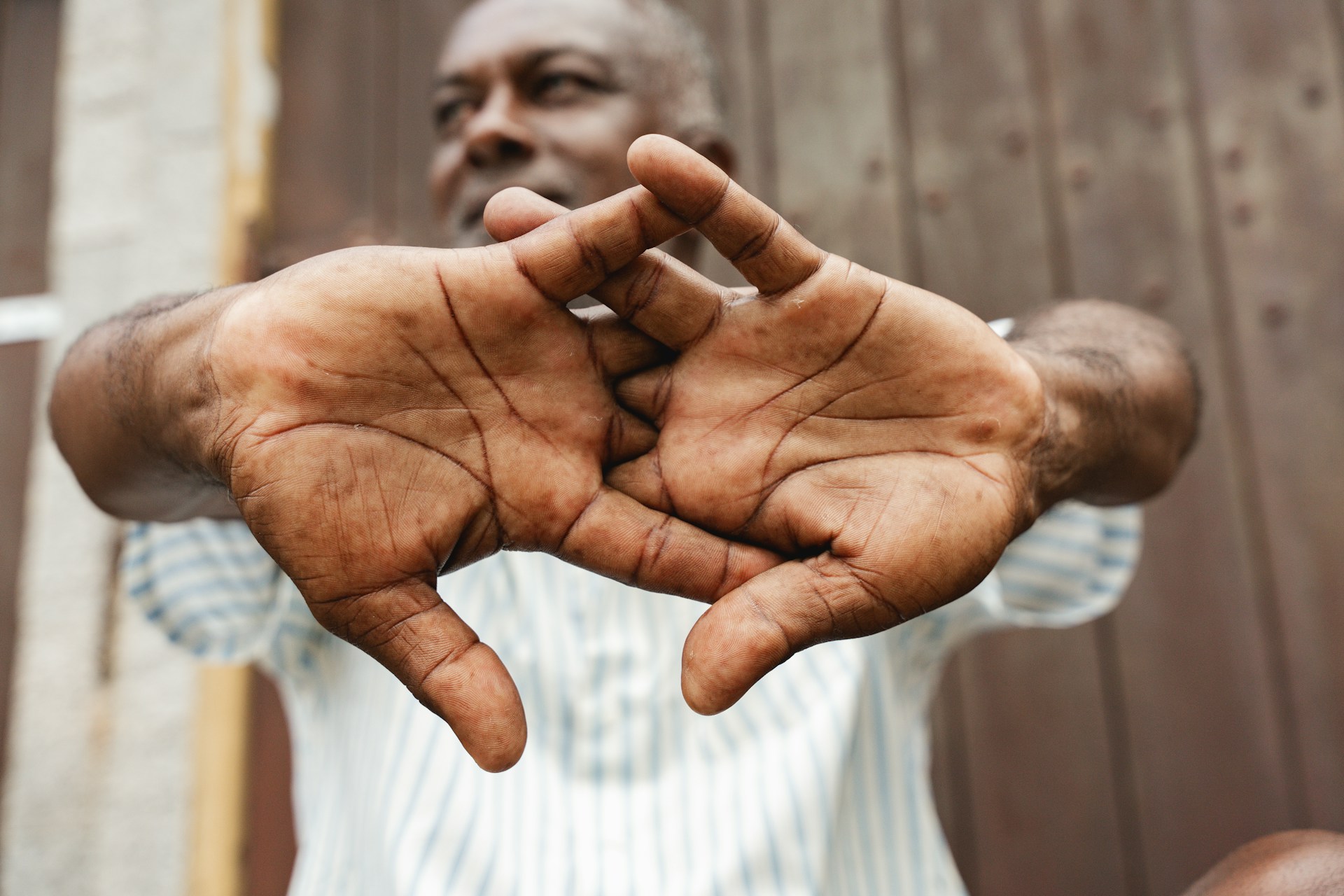 Person holding their hands with fingers extended, illustrating the joints commonly associated with cracking sounds.