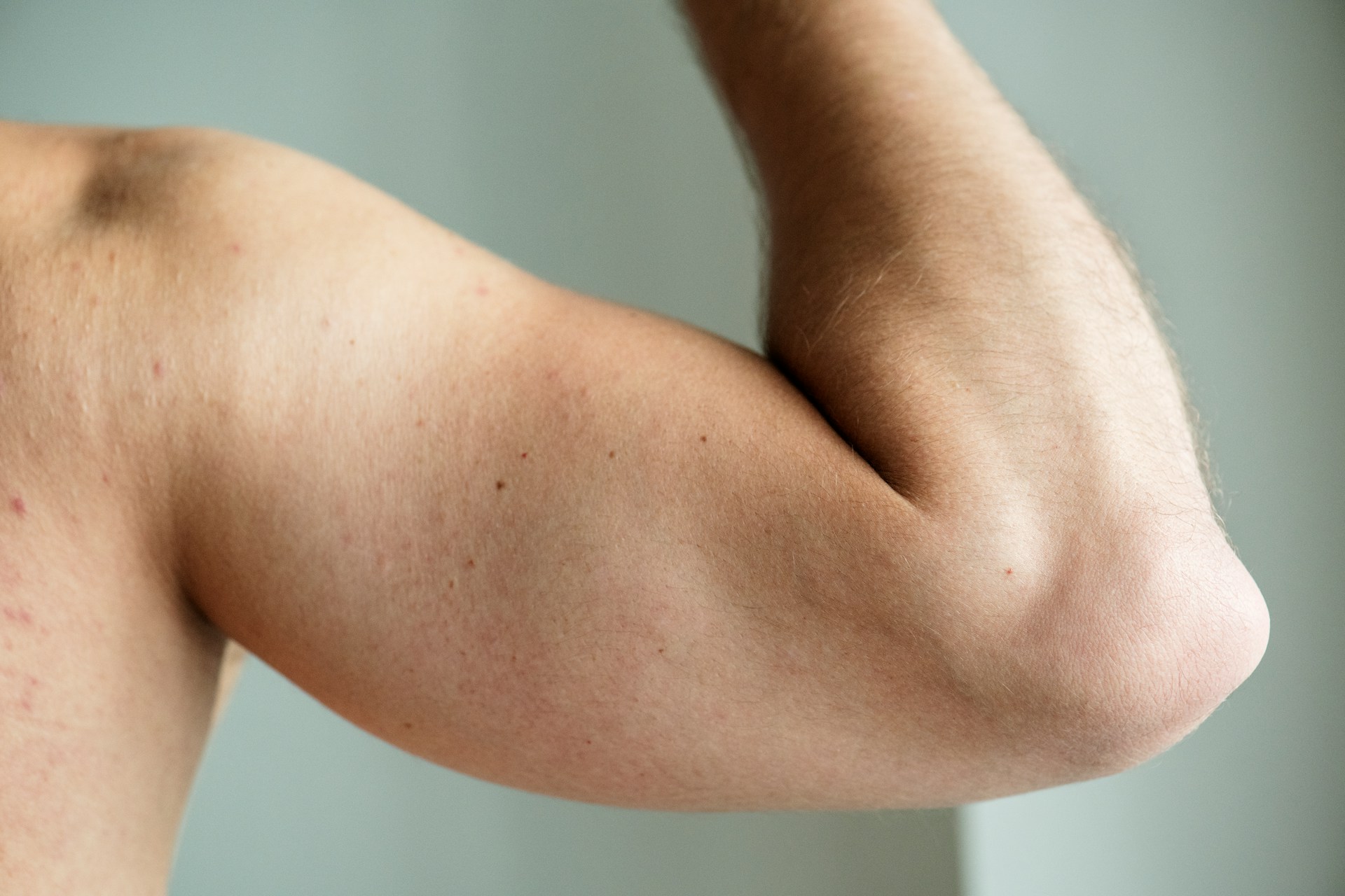 Close-up of a person's upper arm showing the muscles beneath the skin.